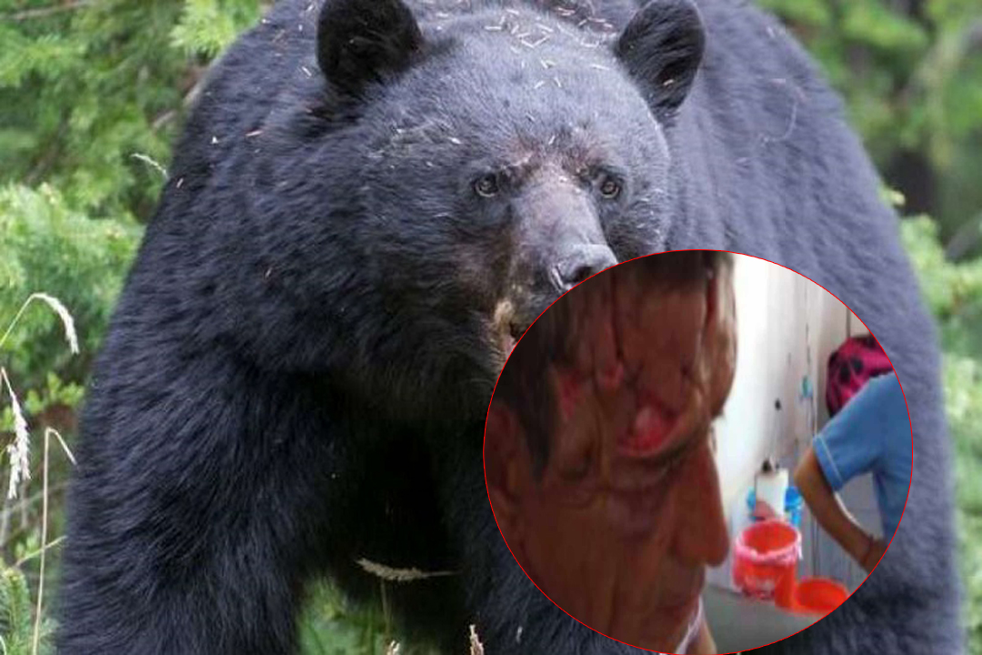 भालुको आक्रमणबाट बैतडीका एक जना गम्भीर घाइते